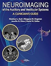 Neuroimaging of the Auditory and Vestibular Systems: A Clinician's Guide