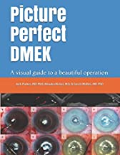 Picture Perfect DMEK: A visual guide to a beautiful operation