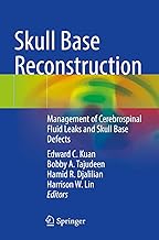 Skull Base Reconstruction: Management of Cerebrospinal Fluid Leaks and Skull Base Defects