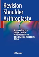 Revision Shoulder Arthroplasty