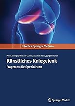 Künstliches Kniegelenk: Fragen an Die Spezialisten