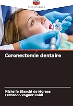 Coronectomie dentaire