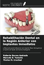 Rehabilitación Dental en la Región Anterior con Implantes Inmediatos: y Reconstrucción Alveolar con Injerto Óseo Xenogénico e Injerto de Tejido Conectivo Autógeno