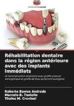 Réhabilitation dentaire dans la région antérieure avec des implants immédiats: et reconstruction alvéolaire avec greffe osseuse xénogénique et greffe de tissu conjonctif autogène