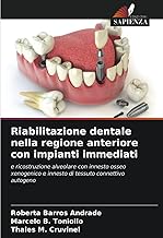 Riabilitazione dentale nella regione anteriore con impianti immediati: e ricostruzione alveolare con innesto osseo xenogenico e innesto di tessuto connettivo autogeno