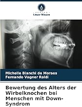 Bewertung des Alters der Wirbelknochen bei Menschen mit Down-Syndrom