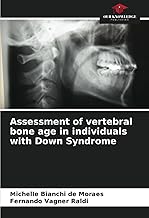 Assessment of vertebral bone age in individuals with Down Syndrome