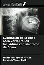 Evaluación de la edad ósea vertebral en individuos con síndrome de Down