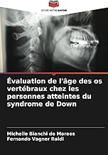 Évaluation de l'âge des os vertébraux chez les personnes atteintes du syndrome de Down