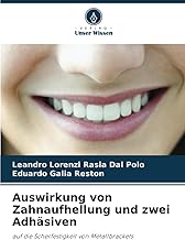 Auswirkung von Zahnaufhellung und zwei Adhäsiven: auf die Scherfestigkeit von Metallbrackets