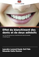 Effet du blanchiment des dents et de deux adhésifs: sur la résistance au cisaillement des brackets métalliques